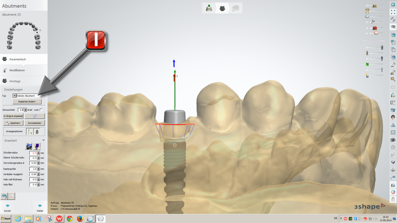Datei:3shape Abut 04 Select Robotic und Anzeigeoptionen 1200.png