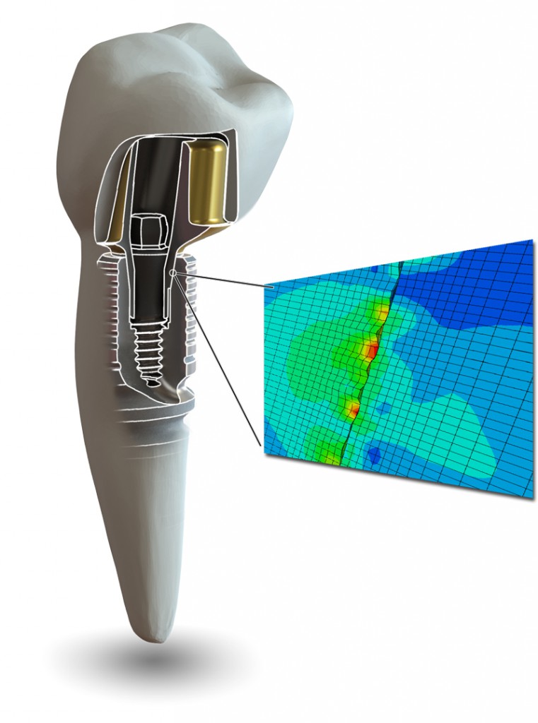 A4L-LTS-BASE-praezision