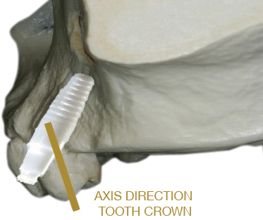 Axis direction Bone model