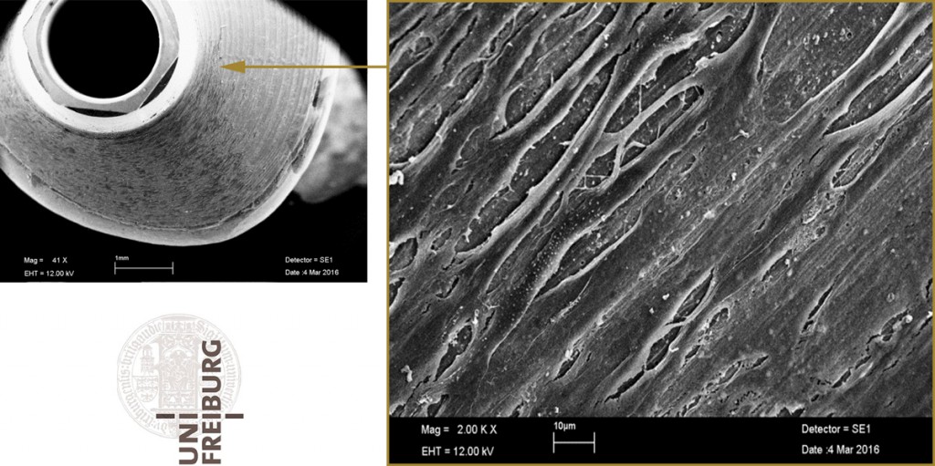 a4l-LTS-base_REM-NCW